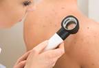 Comparing Total Body Examination vs. Lesion-directed Skin Cancer Screenings Comparing Total Body Examination vs. Lesion-directed Skin Cancer Screenings