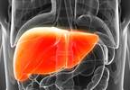 Dietary Fructose Causes Liver Damage in Animal Model Dietary Fructose Causes Liver Damage in Animal Model