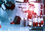 Experimental Drug to Treat Ebola Tested in 3 Patients as Virus Continues to Spread Experimental Drug to Treat Ebola Tested in 3 Patients as Virus Continues to Spread