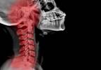 Will the First Human Head Transplant Be Performed by 2017? Will the First Human Head Transplant Be Performed by 2017?
