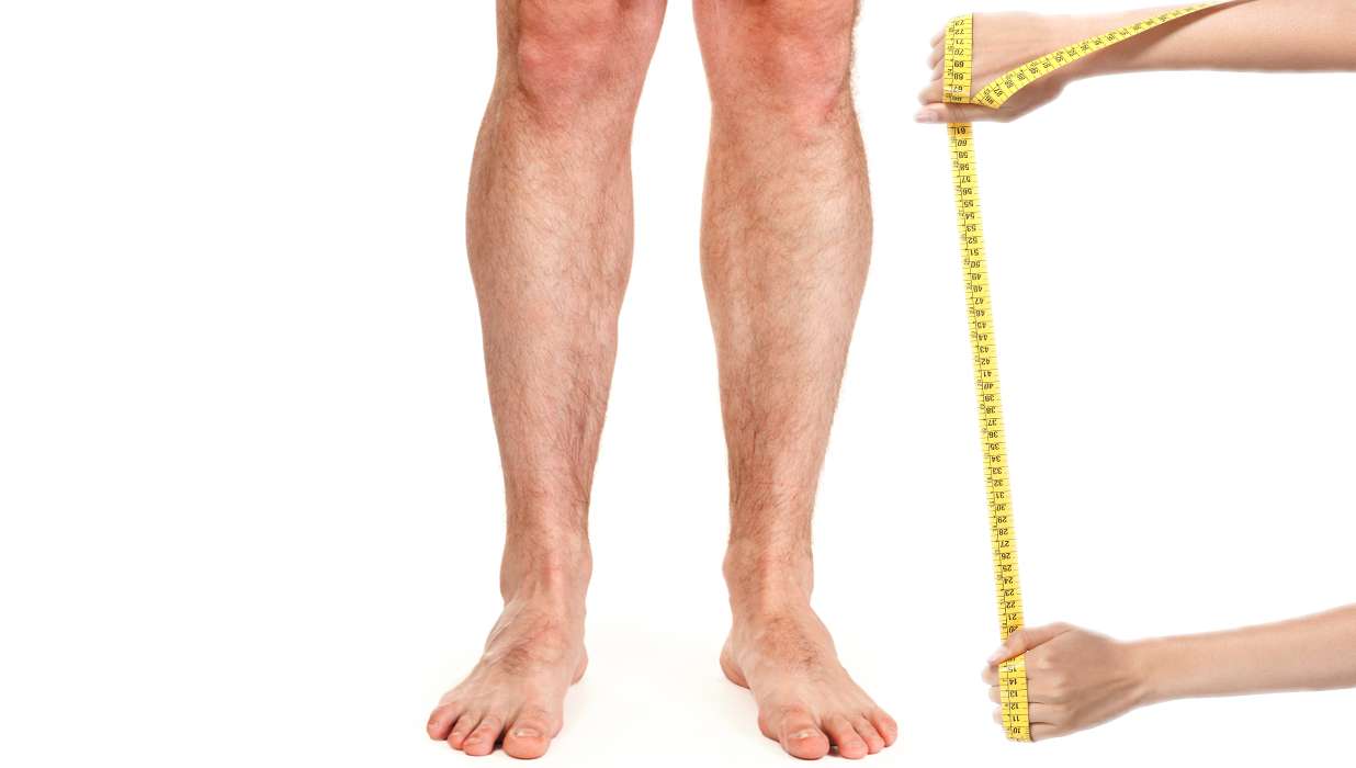 Leg-Lengthening Surgery Mostly Attracts...You Guessed It: Short Men!