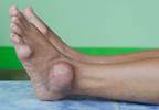 Alternative Medicine in Rheumatology Alternative Medicine in Rheumatology
