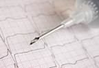Anticoagulation May Not Always Be Needed in Patients With Atrial Fibrillation Anticoagulation May Not Always Be Needed in Patients With Atrial Fibrillation