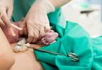 Delayed Clamping Drops Anemia at 8 and 12 Months of Age Delayed Clamping Drops Anemia at 8 and 12 Months of Age