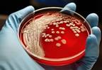 S. aureus Antibiotic Resistance Rates Drop in the United States S. aureus Antibiotic Resistance Rates Drop in the United States