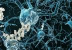 Link Identified Between Alzheimer's Disease and Fungus Link Identified Between Alzheimer's Disease and Fungus