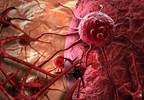Cancer Riddle, Solved Cancer Riddle, Solved