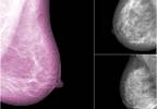 Skilled Radiologists Proven To Detect Breast Cancer In Less Than One Second Skilled Radiologists Proven To Detect Breast Cancer In Less Than One Second