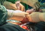 Infants Delivered Via C-Section Associated With Increased Risk of Obesity, Study Finds Infants Delivered Via C-Section Associated With Increased Risk of Obesity, Study Finds
