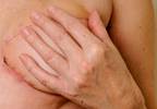 Contralateral Mastectomy Rates Rising Significantly Among Breast Cancer Patients Contralateral Mastectomy Rates Rising Significantly Among Breast Cancer Patients