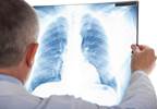 Underlying Cause of Syncope in Elderly May Be Pulmonary Embolism Underlying Cause of Syncope in Elderly May Be Pulmonary Embolism