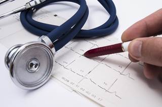 This USPSTF recommendation on ECG screening for CVD events is an update of a 2012 recommendation, which advised against screening in adults with low risk for CHD. This USPSTF recommendation on ECG screening for CVD events is an update of a 2012 recommendation, which advised against screening in adults with low risk for CHD.