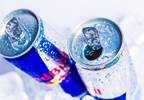 Excessive Energy Drink Consumption Associated with Acute Hepatitis Excessive Energy Drink Consumption Associated with Acute Hepatitis