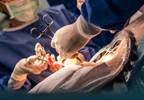 International C-Section Outcomes: The "C" Is Not for Certainty International C-Section Outcomes: The "C" Is Not for Certainty