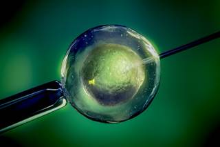 Cost associated with fertility preservation represents one of the most substantial barriers to care for female cancer survivors. Cost associated with fertility preservation represents one of the most substantial barriers to care for female cancer survivors.