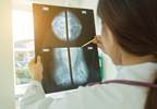 Review of Current Mammography Guidelines in the United States Review of Current Mammography Guidelines in the United States