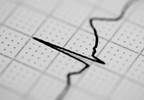 Fragmented QRS Predicts Cardiac Death During Exercise Fragmented QRS Predicts Cardiac Death During Exercise