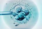 Dexamethasone Improves Outcomes for Patients Undergoing In Vitro Fertilization Dexamethasone Improves Outcomes for Patients Undergoing In Vitro Fertilization