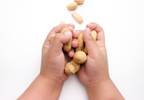 Many Pediatricians Not Adhering to Revised Peanut Allergy Prevention Guidelines Many Pediatricians Not Adhering to Revised Peanut Allergy Prevention Guidelines