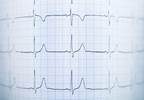 Updated Guidelines Released for Management of Ventricular Arrhythmia, Sudden Cardiac Death Updated Guidelines Released for Management of Ventricular Arrhythmia, Sudden Cardiac Death