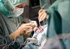 Overlapping Surgery Does Not Compromise Patient Safety in Complex Neurosurgical Cases Overlapping Surgery Does Not Compromise Patient Safety in Complex Neurosurgical Cases