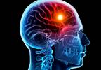 Exploring the Long-Term Effects of Head Injuries on Mental Health Exploring the Long-Term Effects of Head Injuries on Mental Health