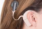 FDA Approves Remote Programming Feature for Cochlear Implant FDA Approves Remote Programming Feature for Cochlear Implant