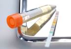 Urine Drug Testing Policy Can Help Clinicians Make Decisions About Opioid Treatment Urine Drug Testing Policy Can Help Clinicians Make Decisions About Opioid Treatment