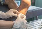 FDA Grants Marketing of First Shock Wave Device for Diabetic Foot Ulcers FDA Grants Marketing of First Shock Wave Device for Diabetic Foot Ulcers