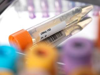 KardiAssure can track adherence to multiple cardiovascular drugs, including atorvastatin, metoprolol, valsartan, and benazepril. KardiAssure can track adherence to multiple cardiovascular drugs, including atorvastatin, metoprolol, valsartan, and benazepril.