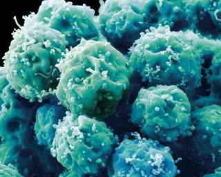The FDA notes that some patients have experienced "serious and permanent harm" after undergoing unapproved stem cell therapies. The FDA notes that some patients have experienced "serious and permanent harm" after undergoing unapproved stem cell therapies.