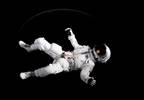 Space Flight-Associated Neuro-Ocular Syndrome Associated With Brain Upward Shift Space Flight-Associated Neuro-Ocular Syndrome Associated With Brain Upward Shift