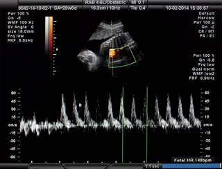 Without widely accepted criteria for predicting postnatal outcomes based on fetal findings, nonclinical factors often influence decision makers. Without widely accepted criteria for predicting postnatal outcomes based on fetal findings, nonclinical factors often influence decision makers.
